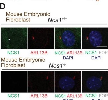 Fig.7.D showing Immunocytochemistry-immunofluorescence from the publication: Myristoylated Neuronal Calcium Sensor-1 captures the preciliary vesicle at distal appendages.