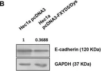 Fig.3.B showing Western Blotting from the publication: Corrigendum: FXYD5/Dysadherin, a biomarker of endometrial cancer myometrial invasion and aggressiveness: its relationship with TGF-β1 and NF-κB pathways.