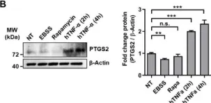 Fig.2.B showing Western Blotting from the publication: The Autophagy Protein Pacer Positively Regulates the Therapeutic Potential of Mesenchymal Stem Cells in a Mouse Model of DSS-Induced Colitis.
