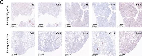 Fig.4.C showing Immunohistochemistry from the publication: In vivo multiplexed modeling reveals diverse roles of the TBX2 subfamily and Egr1 in Kr as-driven lung adenocarcinoma.