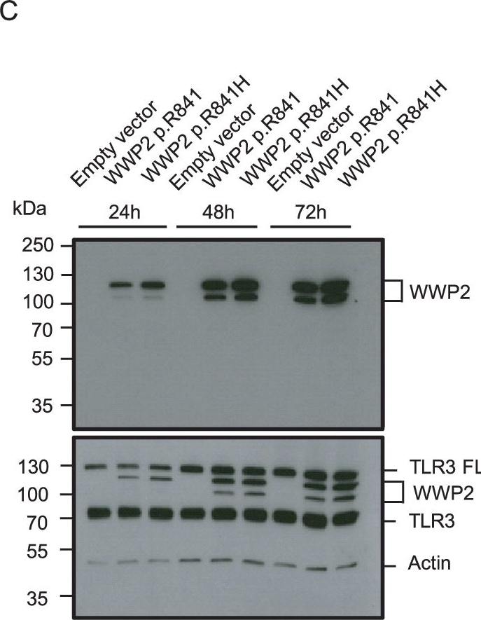 Fig.2.C showing Western Blotting from the publication: Herpes simplex encephalitis due to a mutation in an E3 ubiquitin ligase.