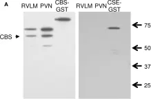 Fig.1.A showing Western Blotting in a Rattus norvegicus (Rat) sample from the publication: Hydrogen Sulfide in the RVLM and PVN has No Effect on Cardiovascular Regulation.