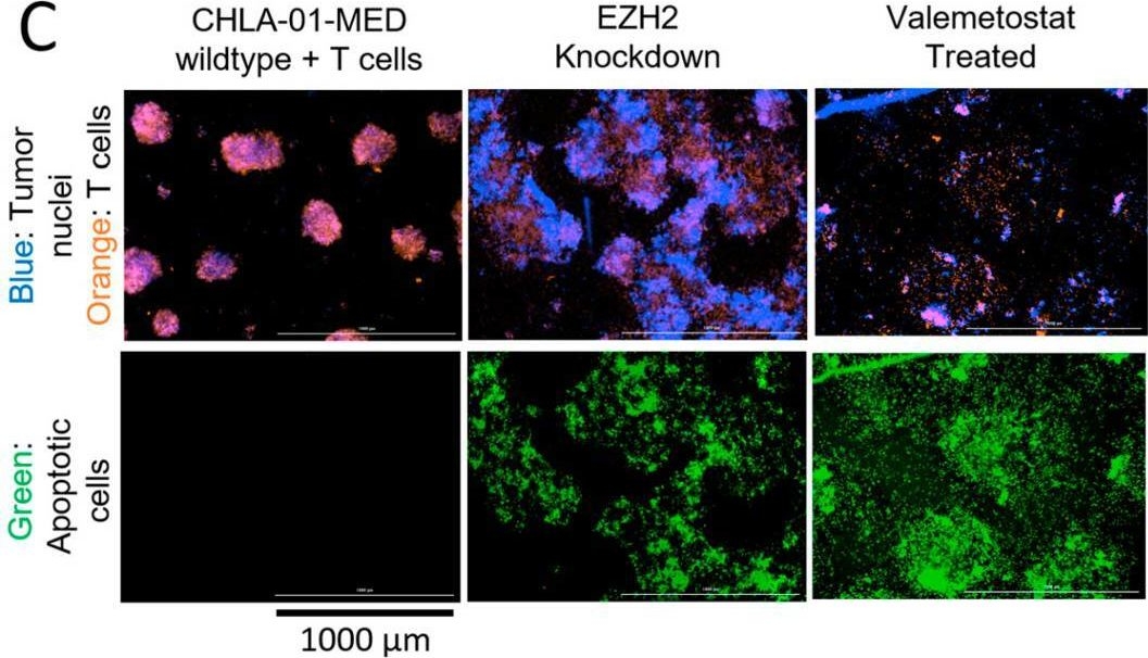 Fig.4.C from the publication: Revealing Pan-Histology Immunomodulatory Targets in Pediatric Central Nervous System Tumors.