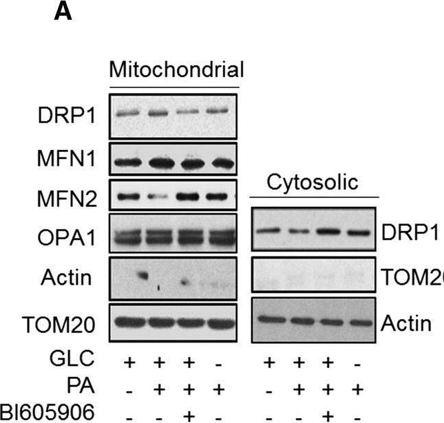 Fig.8.A showing Western Blotting from the publication: Proinflammatory NFkB signalling promotes mitochondrial dysfunction in skeletal muscle in response to cellular fuel overloading.