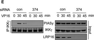 Fig.3.E showing Western Blotting in a Homo sapiens (Human) sample from the publication: An LRP16-containing preassembly complex contributes to NF-κB activation induced by DNA double-strand breaks.