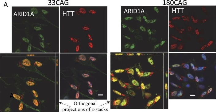 Fig.10.A showing Immunocytochemistry-immunofluorescence in a Homo sapiens (Human) sample from the publication: Huntingtin (HTT) interactome in regulation of DNA repair/remodeling and RNA processing pathways.