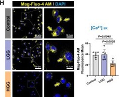 Fig.1.H showing Immunocytochemistry-immunofluorescence from the publication: The MCU-MECOM Axis Orchestrates Glioblastoma Progression by Remodeling Mitochondrial Dynamics and Quality Control via MAMs.