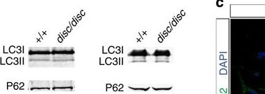 Loss of Wdfy3 in mice alters cerebral cortical neurogenesis reflecting aspects of the autism pathology.