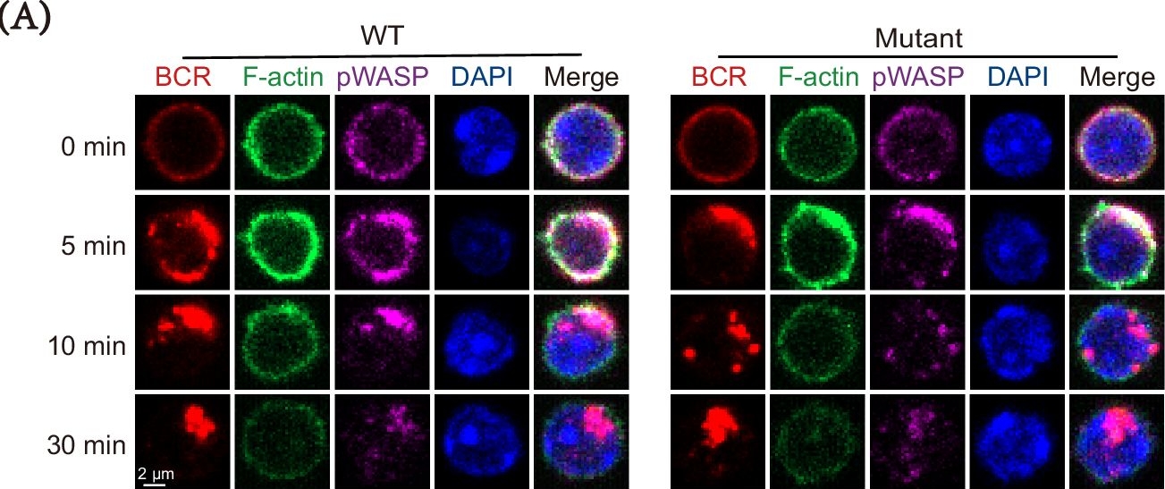 Fig.4.A showing Immunocytochemistry-immunofluorescence from the publication: DOCK8 gene mutation alters cell subsets, BCR signaling, and cell metabolism in B cells.
