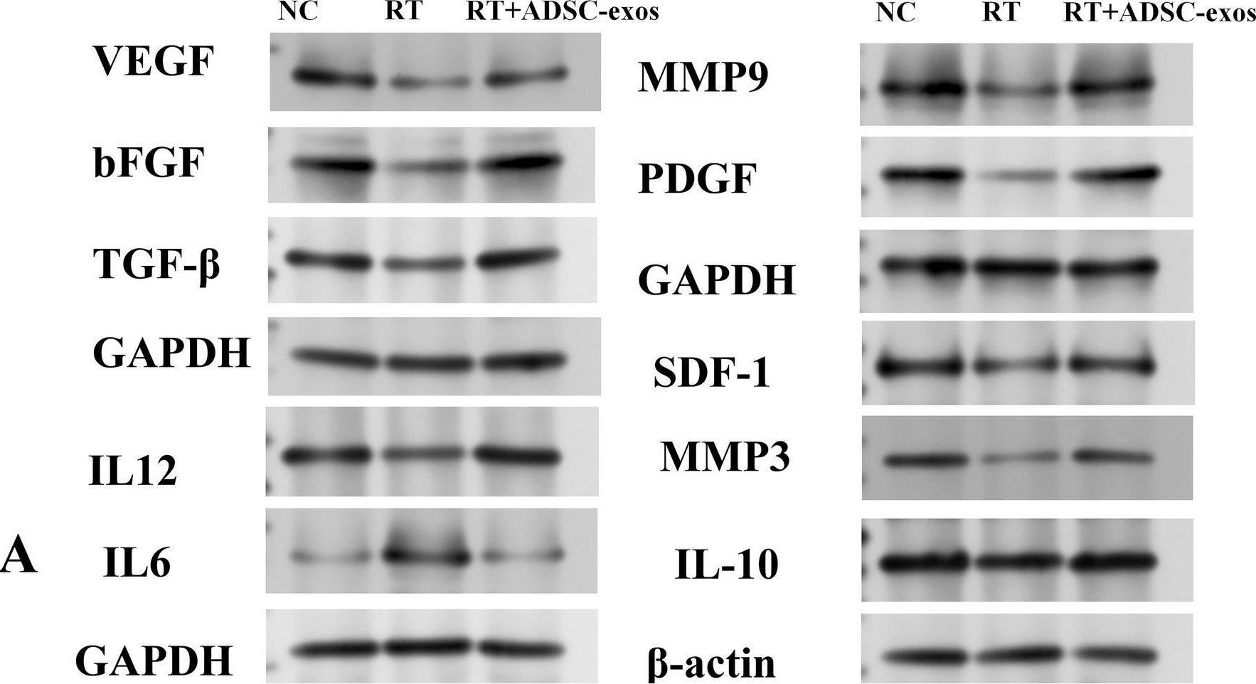 Fig.12.A showing Western Blotting in a Homo sapiens (Human) sample from the publication: Exosomes derived from adipose-derived stem cells alleviate acute radiation-induced dermatitis through up-regulating hyaluronic acid synthase 1 expression.
