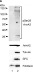 Fig.2.A showing Western Blotting in a Rattus norvegicus (Rat) sample from the publication: Post-translational modifications of Annexin A2 are linked to its association with perinuclear nonpolysomal mRNP complexes.