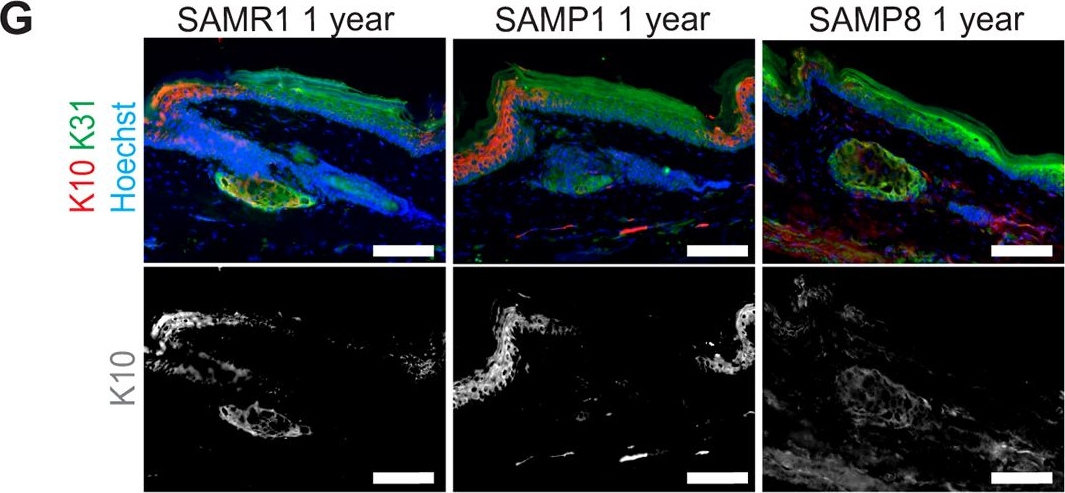 Wild-type and SAMP8 mice show age-dependent changes in distinct stem cell compartments of the interfollicular epidermis.