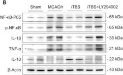 Fig.6.B showing Western Blotting from the publication: Intermittent theta-burst stimulation promotes neurovascular unit remodeling after ischemic stroke in a mouse model.