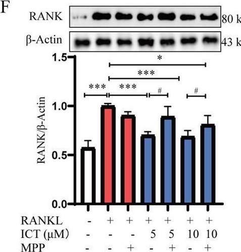 Fig.5.F showing Western Blotting from the publication: Icaritin inhibits osteoclast differentiation and reduces bone loss by targeting ESR1 to inhibit miR503/RANK pathway.