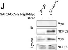 Fig.8.J showing Western Blotting from the publication: E3 ubiquitin ligase NEDD4 inhibits PEDV infection through ubiquitination and degradation of the viral primase NSP8.
