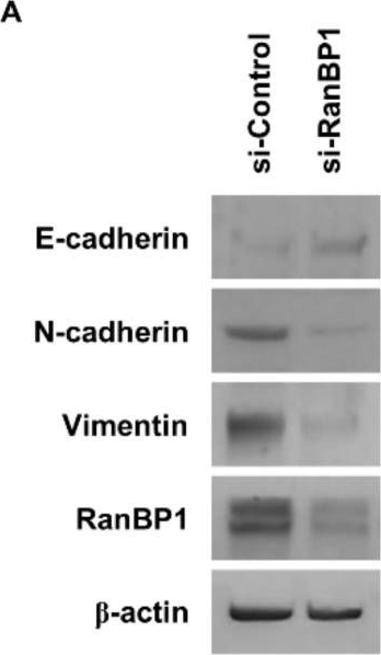 Fig.3.A showing Western Blotting from the publication: RanBP1: A Potential Therapeutic Target for Cancer Stem Cells in Lung Cancer and Glioma.