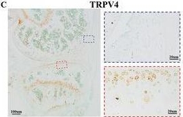Fig.5.C showing Immunohistochemistry in a Mus musculus (House mouse) sample from the publication: LIPUS Promotes Calcium Oscillation and Enhances Calcium Dependent Autophagy of Chondrocytes to Alleviate Osteoarthritis.