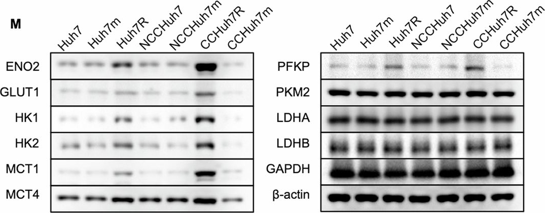 Fig.2.M showing Western Blotting from the publication: BNIP3-mediated mitophagy boosts the competitive growth of Lenvatinib-resistant cells via energy metabolism reprogramming in HCC.
