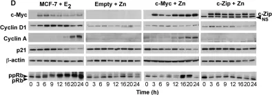Fig.1.D showing Western Blotting in a Homo sapiens (Human) sample from the publication: Identification of functional networks of estrogen- and c-Myc-responsive genes and their relationship to response to tamoxifen therapy in breast cancer.