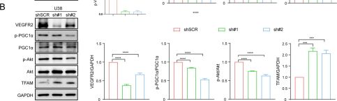 Phospho-Akt (Thr308) (244F9) Rabbit mAb | Cell Signaling Technology