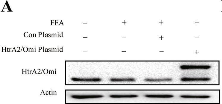 Fig.6.A showing Western Blotting from the publication: HtrA2/Omi mitigates NAFLD in high-fat-fed mice by ameliorating mitochondrial dysfunction and restoring autophagic flux.