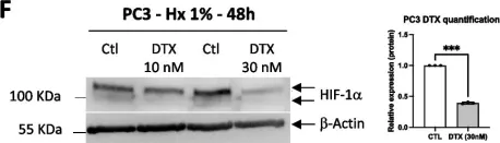 Fig.5.F showing Western Blotting in a Homo sapiens (Human) sample from the publication: The marine-derived HIF-1α inhibitor, Yardenone 2, reduces prostate cancer cell proliferation by targeting HIF-1 target genes.
