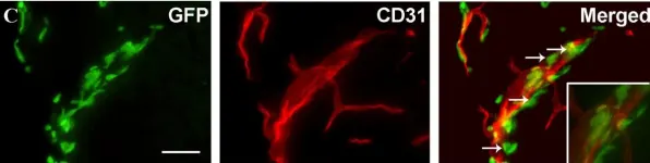 Fig.3.C showing Immunohistochemistry-immunofluorescence in a Mus musculus (House mouse) sample from the publication: Interleukin-1beta and tumor necrosis factor-alpha are expressed by different subsets of microglia and macrophages after ischemic stroke in mice.
