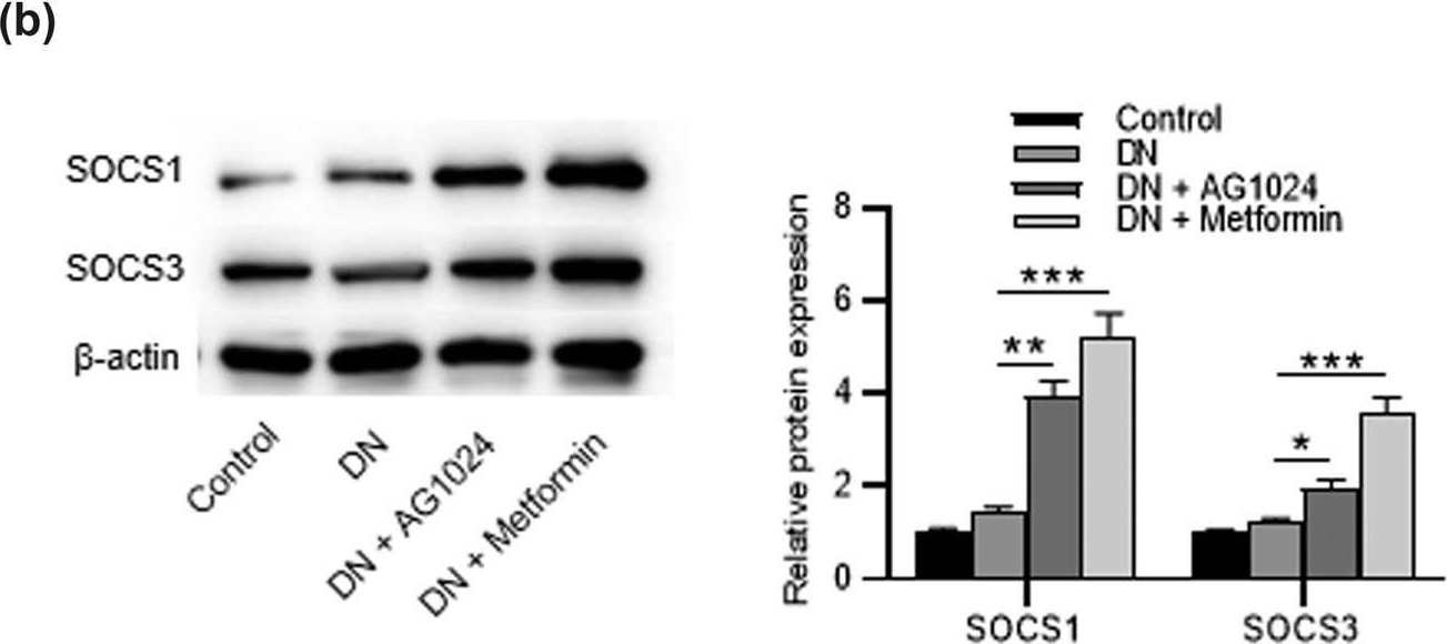 Fig.5.B showing Western Blotting from the publication: AG1024, an IGF-1 receptor inhibitor, ameliorates renal injury in rats with diabetic nephropathy via the SOCS/JAK2/STAT pathway.