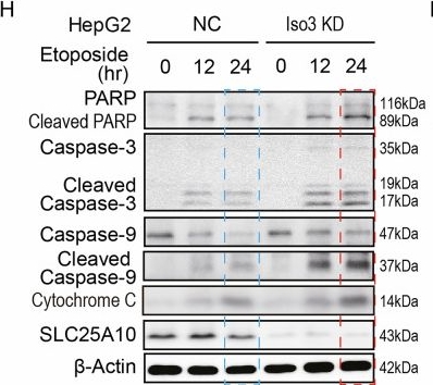 Fig.3.H showing Western Blotting from the publication: Nuclear translocation of SLC25A10 isoform 3 promotes chemoresistance in HCC cells via CEBPB/BCL2A1 signaling.