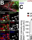 Fig.6.B showing Immunocytochemistry-immunofluorescence in a Homo sapiens (Human) sample from the publication: A SNX1-SNX2-VAPB partnership regulates endosomal membrane rewiring in response to nutritional stress.