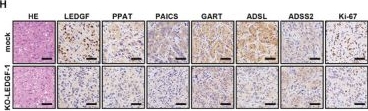 Fig.8.H showing Immunohistochemistry in a Mus musculus (House mouse) sample from the publication: LEDGF Binds H3R17me2a Promoting De Novo Nucleotide Biosynthesis in SETD2 Mutant Clear Cell Renal Cell Carcinoma.