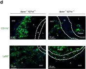 Fig.2.D showing Immunofluorescence in a Mus musculus (House mouse) sample from the publication: IL-27 receptor-regulated stress myelopoiesis drives abdominal aortic aneurysm development.