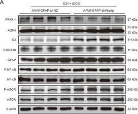 Fig.6.A showing Western Blotting from the publication: HD-tDCS Restores Perivascular AQP4 Polarization via PPARγ Modulation to Enhance Glymphatic Clearance After Intracerebral Hemorrhage in Mice.