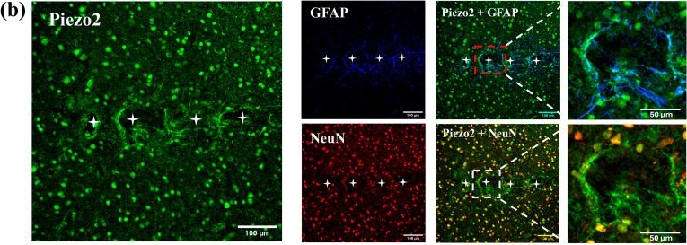 Fig.4.B showing Immunohistochemistry-immunofluorescence in a Rattus norvegicus (Rat) sample from the publication: Piezo1 and Piezo2 Ion Channels in Neuronal and Astrocytic Responses to MEA Implants in the Rat Somatosensory Cortex.
