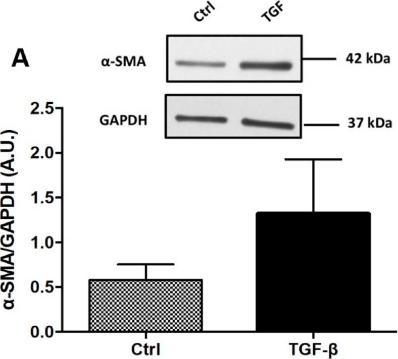 Fig.1.A showing Western Blotting in a Homo sapiens (Human) sample from the publication: Dietary AhR Ligands Have No Anti-Fibrotic Properties in TGF-β1-Stimulated Human Colonic Fibroblasts.