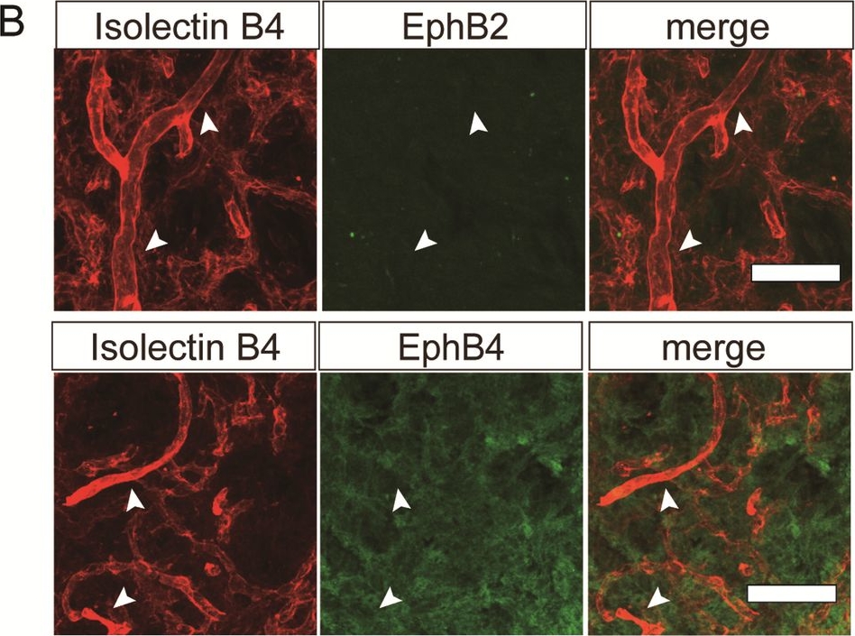 Fig.4.B showing Immunohistochemistry-immunofluorescence in a Mus musculus (House mouse) sample from the publication: Notch4 is essential for the maintenance of vascular homeostasis in the young adult pituitary posterior lobes.