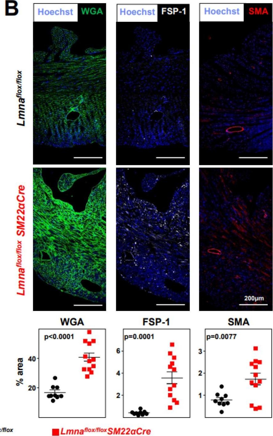 Fig.5.B showing Immunohistochemistry-immunofluorescence from the publication: Lamin A/C Ablation Restricted to Vascular Smooth Muscle Cells, Cardiomyocytes, and Cardiac Fibroblasts Causes Cardiac and Vascular Dysfunction.