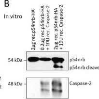 Fig.5.B showing Western Blotting in a Homo sapiens (Human) sample from the publication: The caspase-2 substrate p54nrb exhibits a multifaceted role in tumor cell death susceptibility via gene regulatory functions.