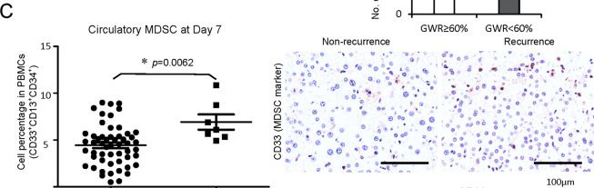 Fig.1.C showing Immunohistochemistry in a Homo sapiens (Human) sample from the publication: Monocytic MDSC mobilization promotes tumor recurrence after liver transplantation via CXCL10/TLR4/MMP14 signaling.