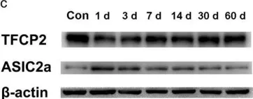Fig.2.C showing Western Blotting from the publication: Glucose Deficiency Elevates Acid-Sensing Ion Channel 2a Expression and Increases Seizure Susceptibility in Temporal Lobe Epilepsy.