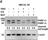 Fig.7.D showing Western Blotting in a Homo sapiens (Human) sample from the publication: Three-dimensional tumor cell growth stimulates autophagic flux and recapitulates chemotherapy resistance.