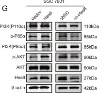 Fig.5.G showing Western Blotting from the publication: Transcription cofactor Hes6 interacts with Twist1 to facilitate EMT and promote gastric carcinogenesis by activating the PI3K/AKT signaling.