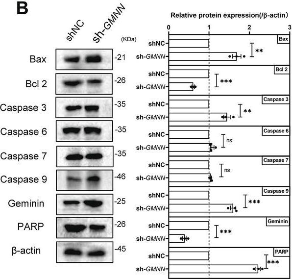 Fig.1.B showing Western Blotting in a Homo sapiens (Human) sample from the publication: Lysophosphatidic acid suppresses apoptosis of high-grade serous ovarian cancer cells by inducing autophagy activity and promotes cell-cycle progression via EGFR-PI3K/Aurora-AThr288-geminin dual signaling pathways.