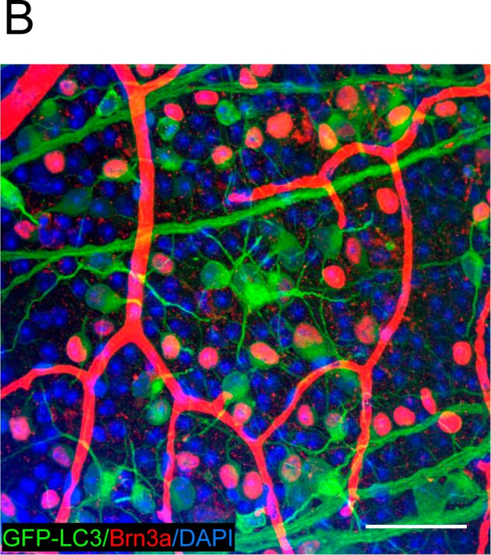 Anti-Brn-3a Antibody, POU-domain protein, clone 5A3.2