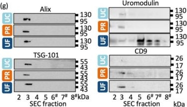 Fig.2.G showing Western Blotting in a Homo sapiens (Human) sample from the publication: Size-Exclusion Chromatography Separation Reveals That Vesicular and Non-Vesicular Small RNA Profiles Differ in Cell Free Urine.