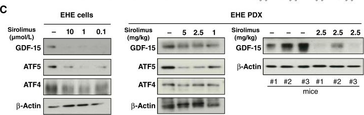 Fig.4.C showing Western Blotting from the publication: GDF-15 Predicts Epithelioid Hemangioendothelioma Aggressiveness and Is Downregulated by Sirolimus through ATF4/ATF5 Suppression.