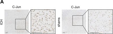 Fig.2.A showing Immunohistochemistry from the publication: METTL3 inhibition alleviates neuroinflammation and apoptosis by reducing ETV4 m6A modification.