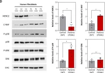 Fig.1.D showing Western Blotting from the publication: HERC2 deficiency activates C-RAF/MKK3/p38 signalling pathway altering the cellular response to oxidative stress.