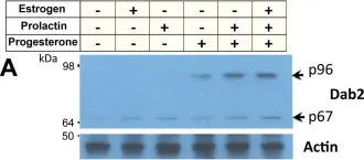 Fig.2.A showing Western Blotting in a Mus musculus (House mouse) sample from the publication: Hormonal induction and roles of Disabled-2 in lactation and involution.