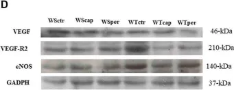 Fig.2.D showing Western Blotting from the publication: Exercise-induced angiogenesis is attenuated by captopril but maintained under perindopril treatment in hypertensive rats.